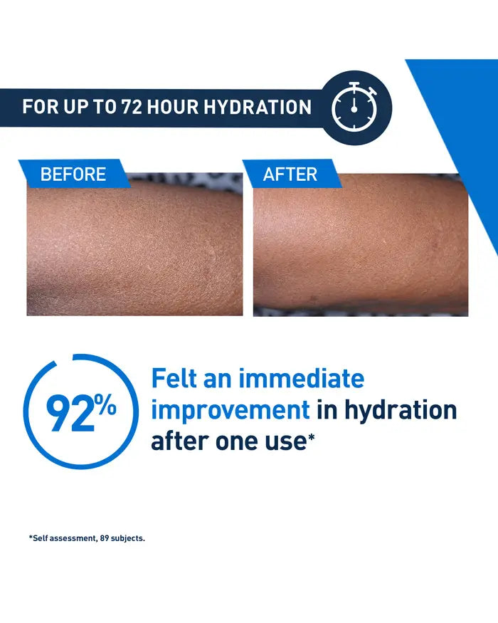 Before and after comparison of skin hydration with text indicating 92% improvement after one use.